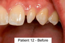 Patient 8 - Before