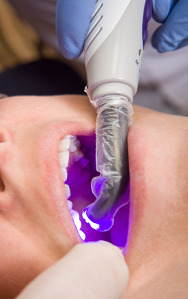 Aftercare Tips For Dental Fillings